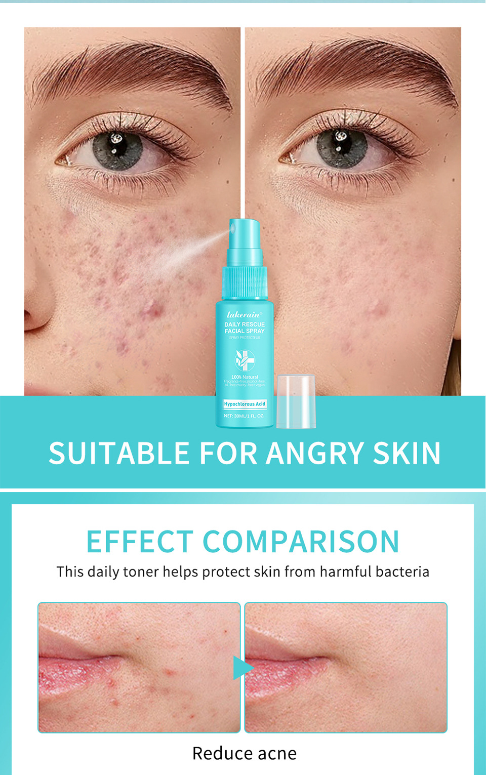 Hypochlorous Acid Calming Face Mist – 30ml