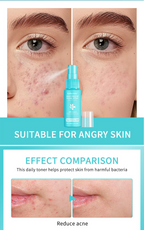 Hypochlorous Acid Calming Face Mist – 30ml