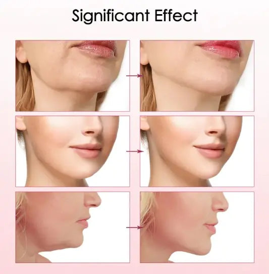 Glow Jawline Massager comparison photos